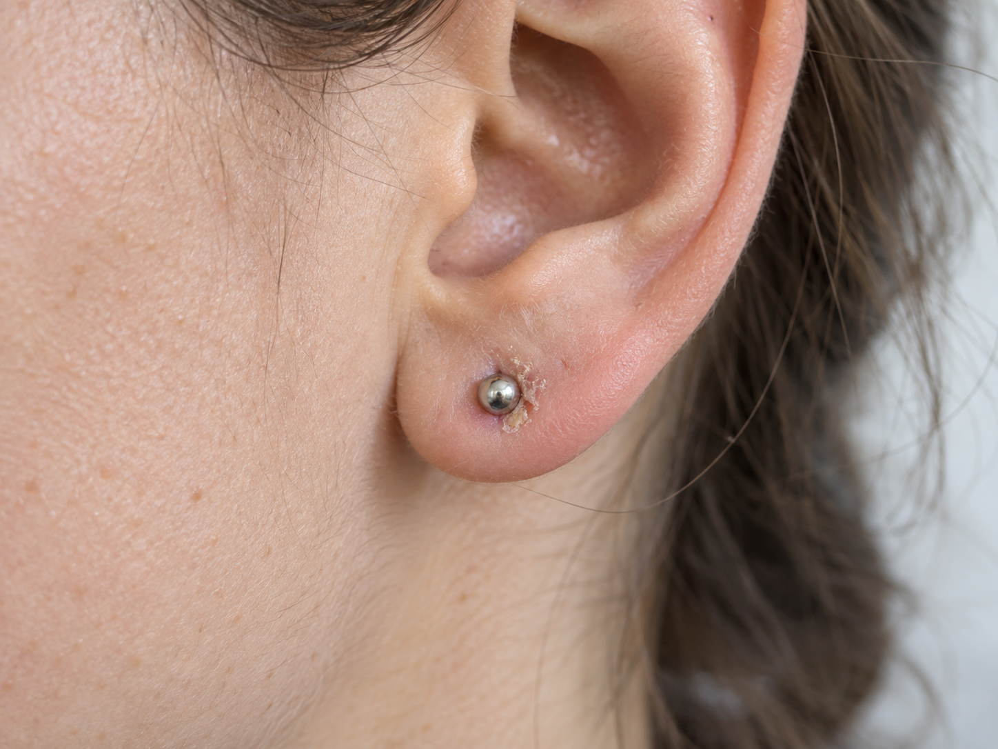 Piercing in guarigione con una piccola crosta e una goccia di secrezione chiara, rappresentata senza dettagli grafici.